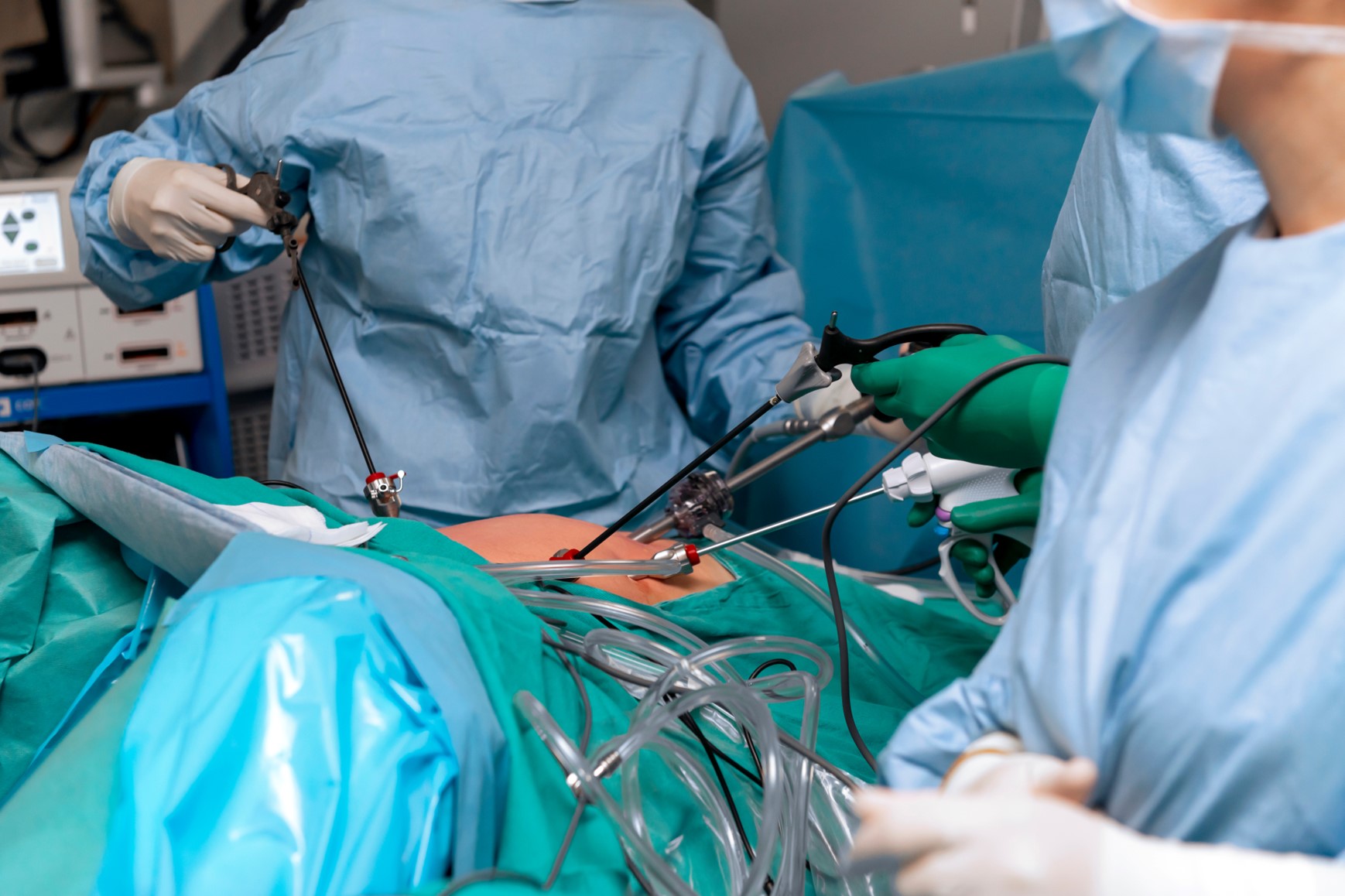 Laparoscopic Hysterectomy: A Minimally Invasive Solution for Women - dr ...